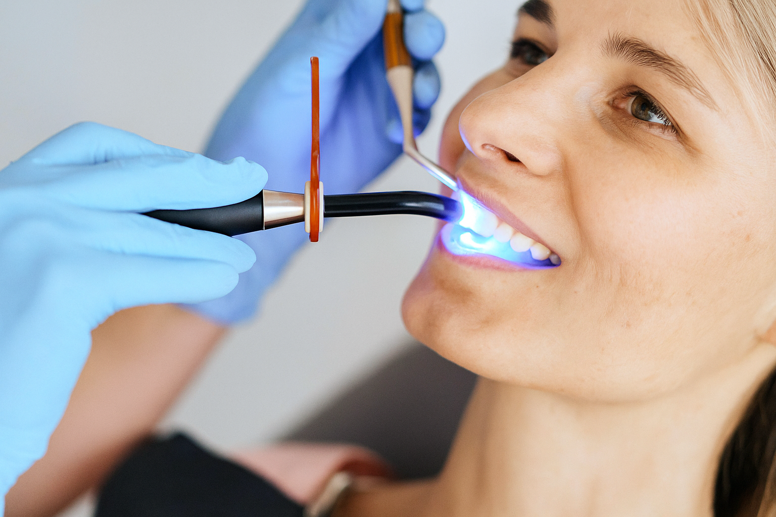 A dental laser tool used for LaserSmile teeth whitening.