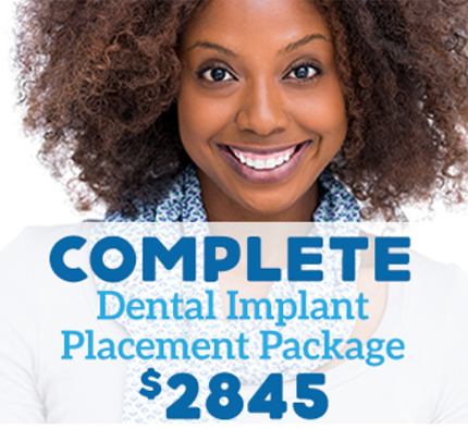 complete-dental-implant